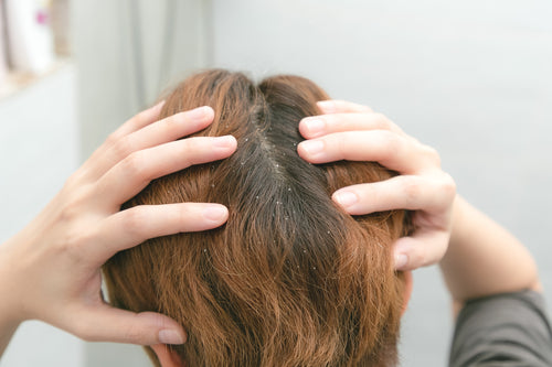Scalp status preview grid