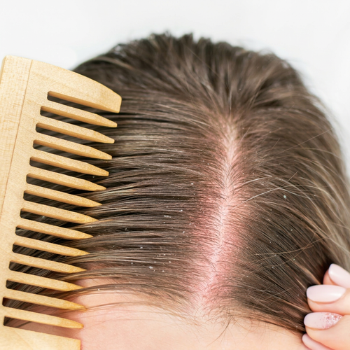 Scalp status preview grid